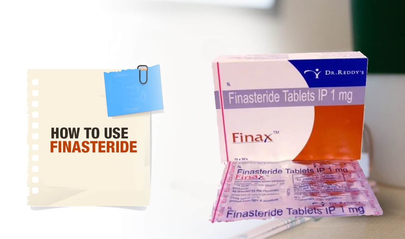How To Use Finasteride