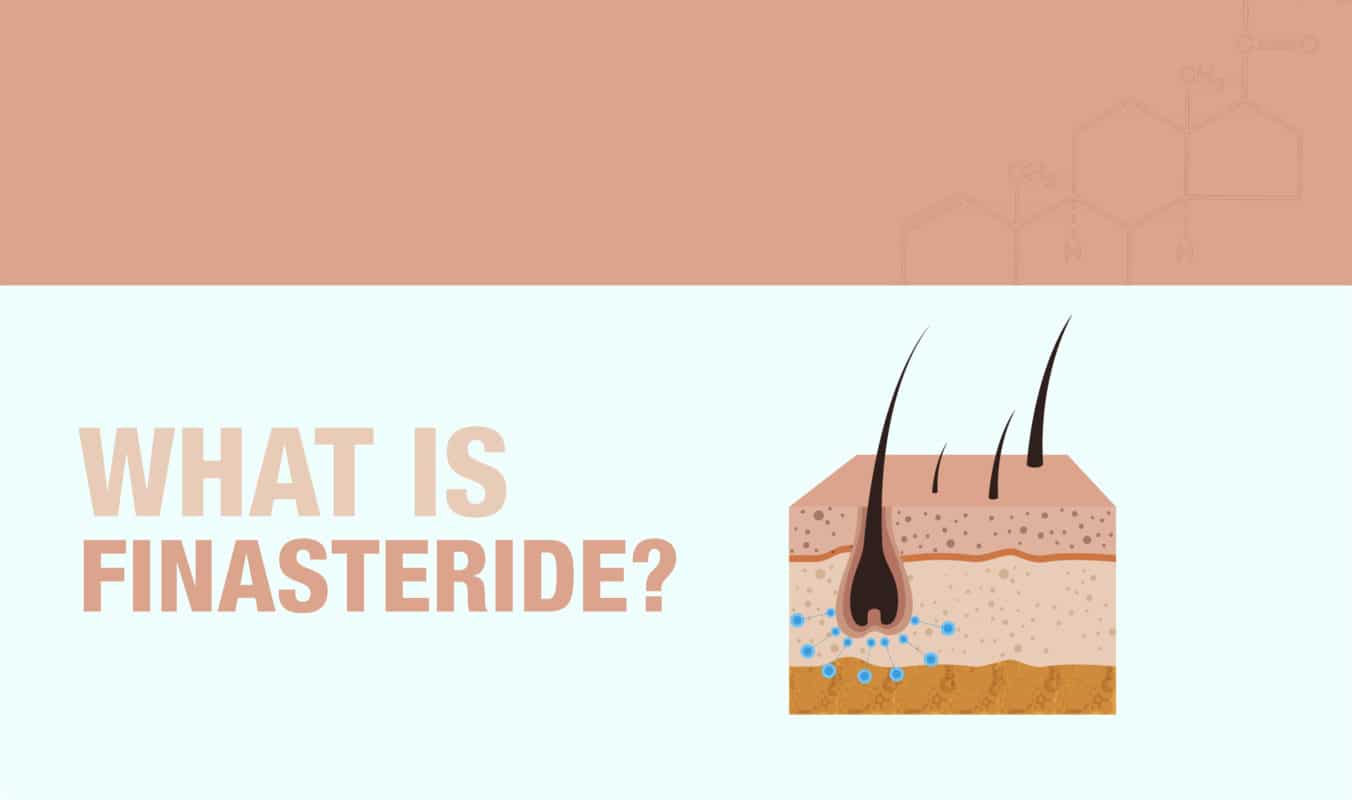What is Finasteride