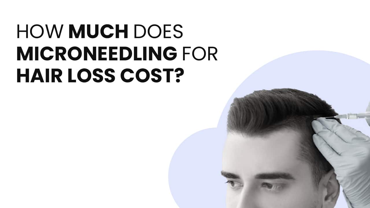 How much does microneedling for hair loss cost