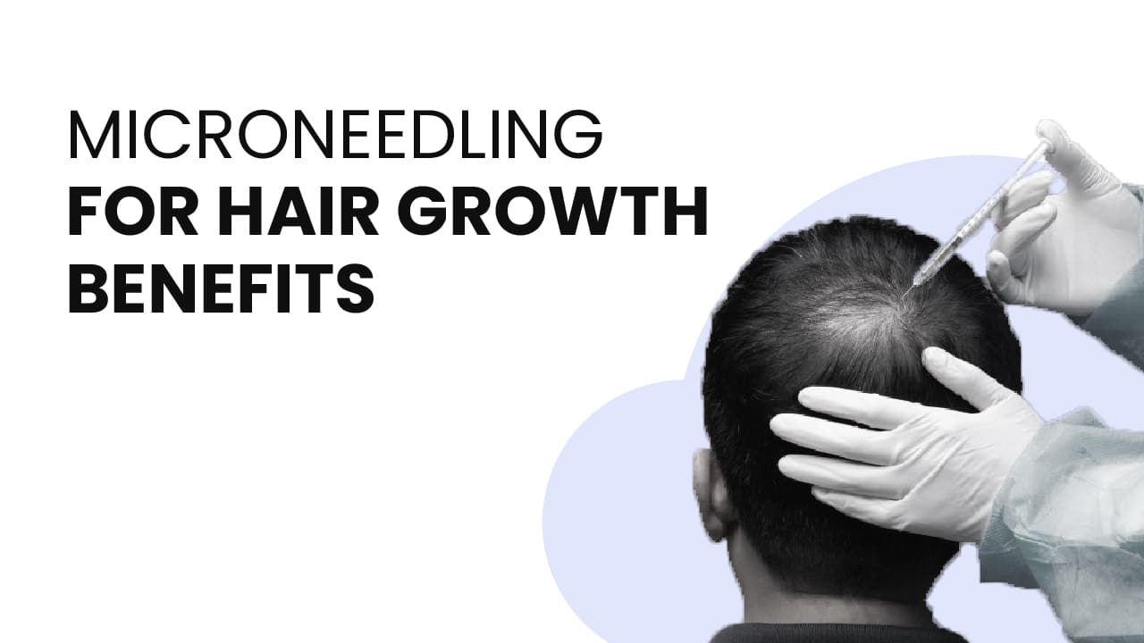 Microneedling for hair growth benefits
