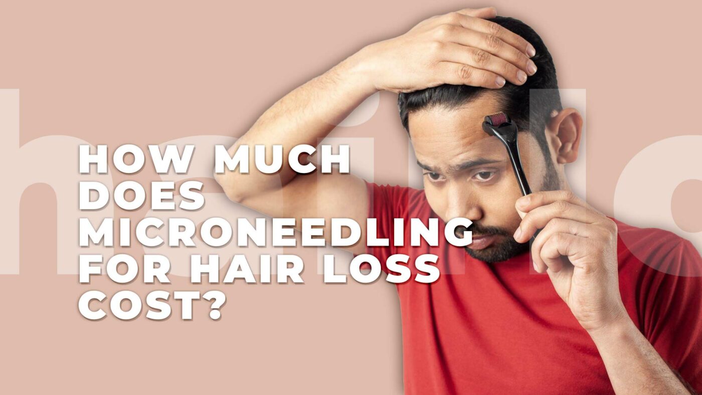 3. How much does microneedling for hair loss cost